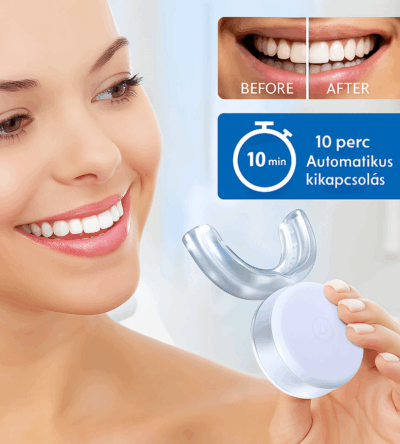 LuxeSmile Kit – Mini